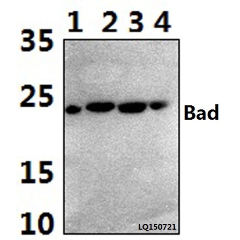 Anti-Bad (I106) Antibody from Bioworld Technology (BS1413) - Antibodies.com