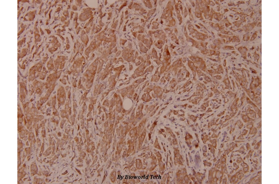 Anti-Bad (I106) Antibody from Bioworld Technology (BS1413) - Antibodies.com