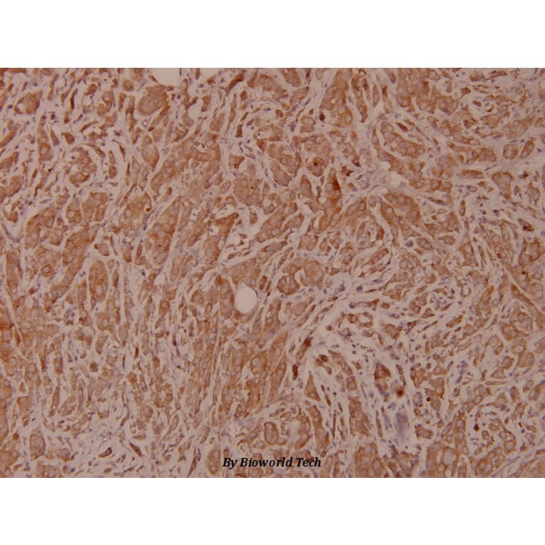 Anti-Bad (I106) Antibody from Bioworld Technology (BS1413) - Antibodies.com