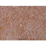 Anti-Bad (I106) Antibody from Bioworld Technology (BS1413) - Antibodies.com