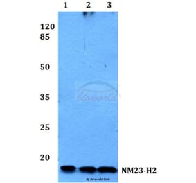 Anti-NM23-H2 (H118) Antibody from Bioworld Technology (BS1415) - Antibodies.com