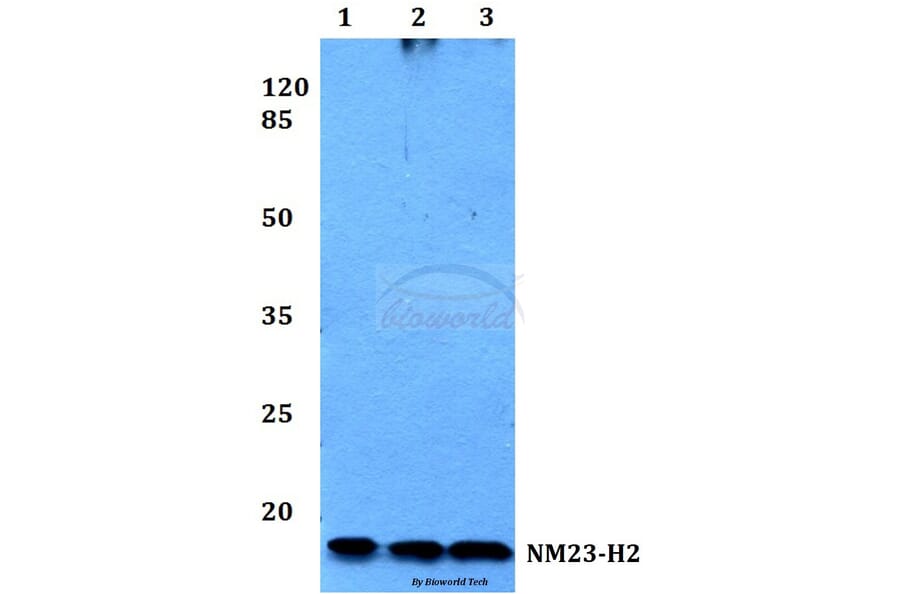 Anti-NM23-H2 (H118) Antibody from Bioworld Technology (BS1415) - Antibodies.com