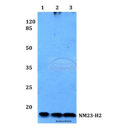 Anti-NM23-H2 (H118) Antibody from Bioworld Technology (BS1415) - Antibodies.com