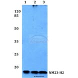 Anti-NM23-H2 (H118) Antibody from Bioworld Technology (BS1415) - Antibodies.com