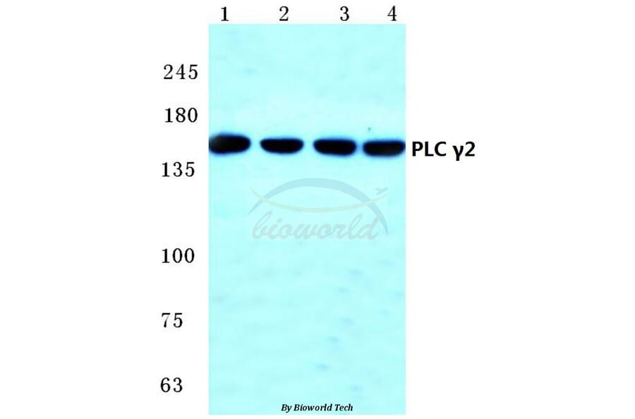 Anti-PLC γ2 (R747) Antibody from Bioworld Technology (BS1418) - Antibodies.com