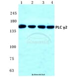 Anti-PLC γ2 (R747) Antibody from Bioworld Technology (BS1418) - Antibodies.com