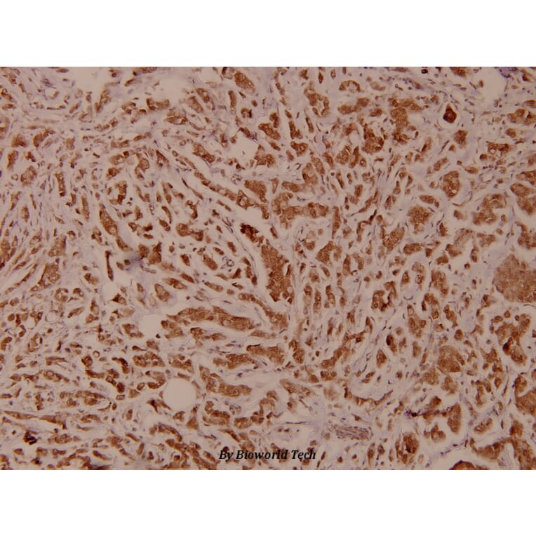 Anti-PLC γ2 (R747) Antibody from Bioworld Technology (BS1418) - Antibodies.com