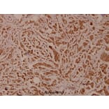Anti-PLC γ2 (R747) Antibody from Bioworld Technology (BS1418) - Antibodies.com