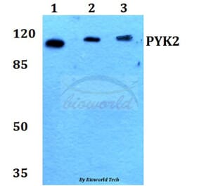 Anti-PYK2 (I574) Antibody from Bioworld Technology (BS1420) - Antibodies.com