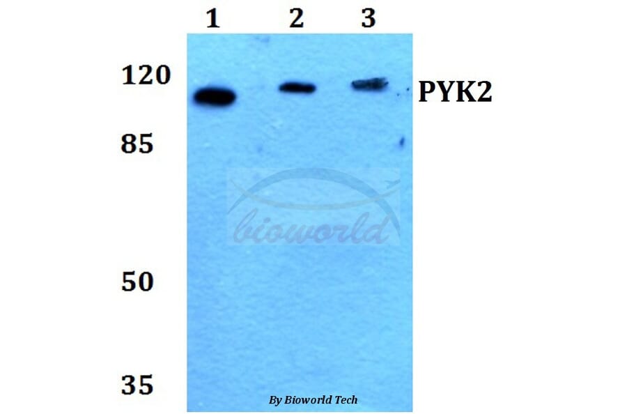Anti-PYK2 (I574) Antibody from Bioworld Technology (BS1420) - Antibodies.com