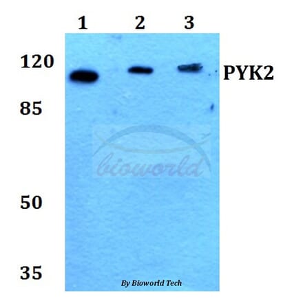 Anti-PYK2 (I574) Antibody from Bioworld Technology (BS1420) - Antibodies.com