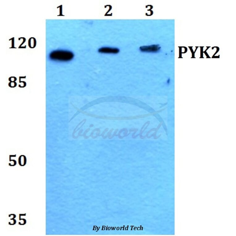 Anti-PYK2 (I574) Antibody from Bioworld Technology (BS1420) - Antibodies.com