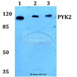 Anti-PYK2 (I574) Antibody from Bioworld Technology (BS1420) - Antibodies.com