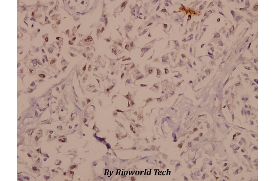 Anti-PYK2 (I574) Antibody from Bioworld Technology (BS1420) - Antibodies.com