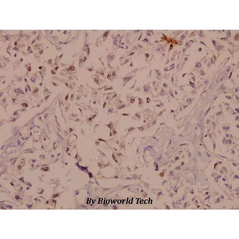 Anti-PYK2 (I574) Antibody from Bioworld Technology (BS1420) - Antibodies.com