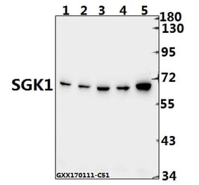 Anti-SGK1 (E416) Antibody from Bioworld Technology (BS1422) - Antibodies.com