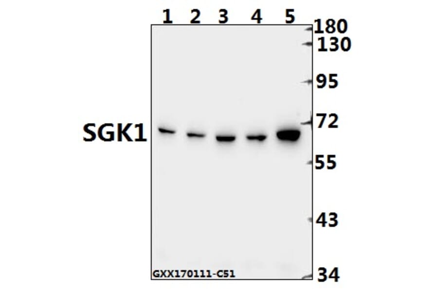 Anti-SGK1 (E416) Antibody from Bioworld Technology (BS1422) - Antibodies.com