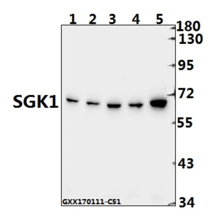 Anti-SGK1 (E416) Antibody from Bioworld Technology (BS1422) - Antibodies.com
