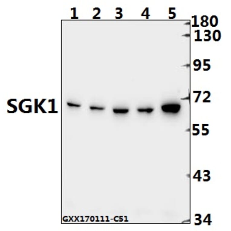Anti-SGK1 (E416) Antibody from Bioworld Technology (BS1422) - Antibodies.com