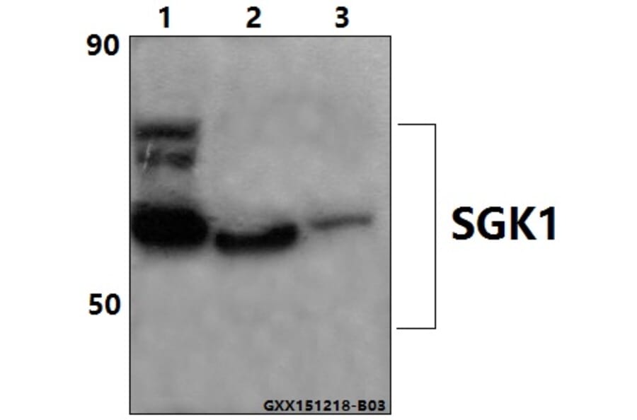 Anti-SGK1 (E416) Antibody from Bioworld Technology (BS1422) - Antibodies.com