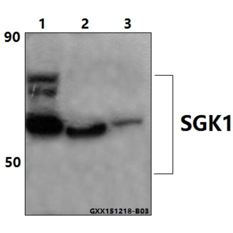 Anti-SGK1 (E416) Antibody from Bioworld Technology (BS1422) - Antibodies.com