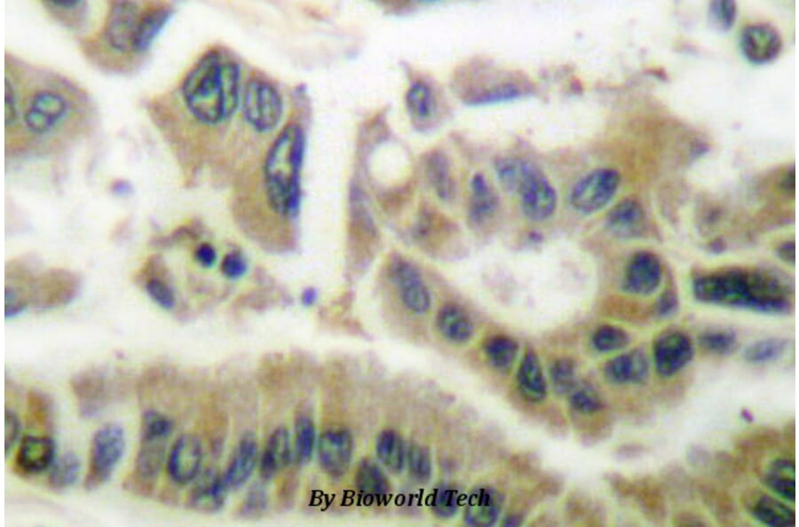 Anti-SGK1 (E416) Antibody from Bioworld Technology (BS1422) - Antibodies.com