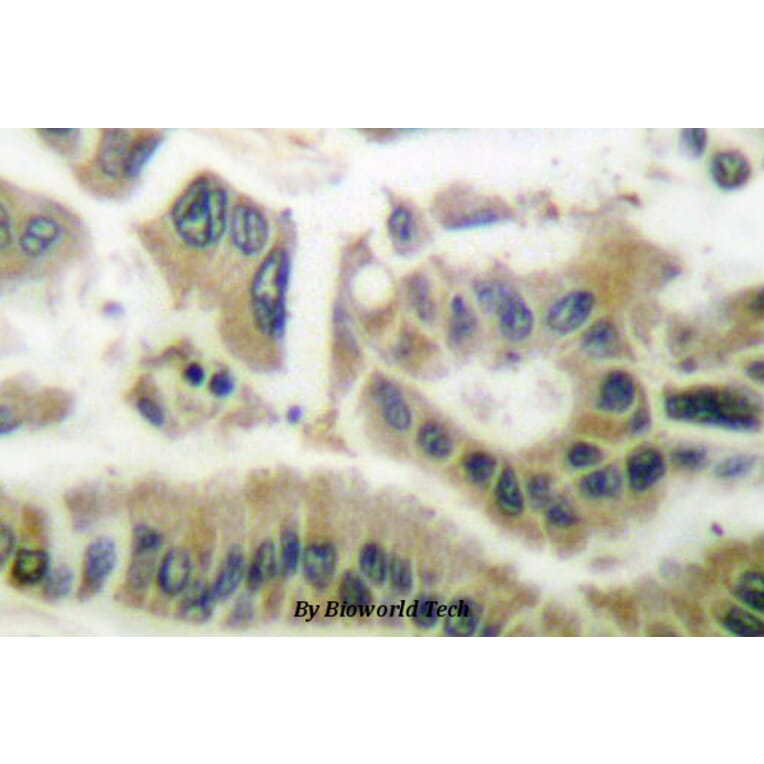 Anti-SGK1 (E416) Antibody from Bioworld Technology (BS1422) - Antibodies.com