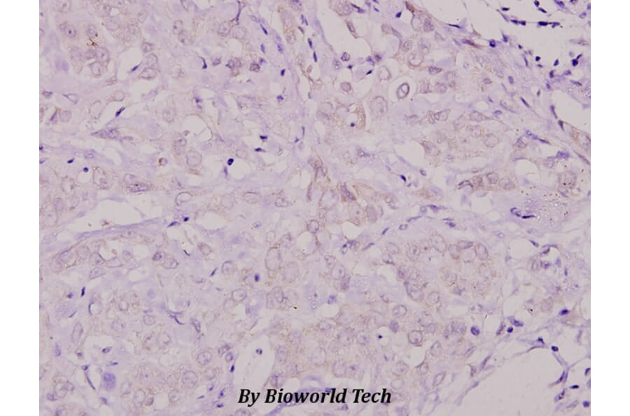 Anti-Shc (L421) Antibody from Bioworld Technology (BS1423) - Antibodies.com