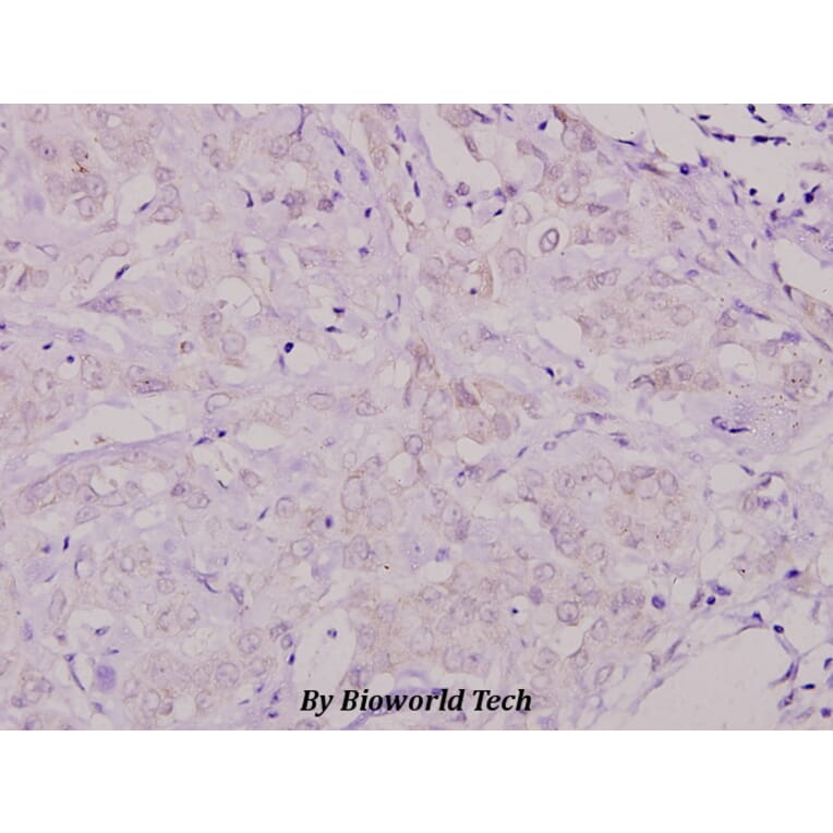Anti-Shc (L421) Antibody from Bioworld Technology (BS1423) - Antibodies.com