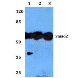 Anti-Smad2 (P459) Antibody from Bioworld Technology (BS1425) - Antibodies.com