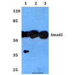 Anti-Smad2 (P459) Antibody from Bioworld Technology (BS1425) - Antibodies.com