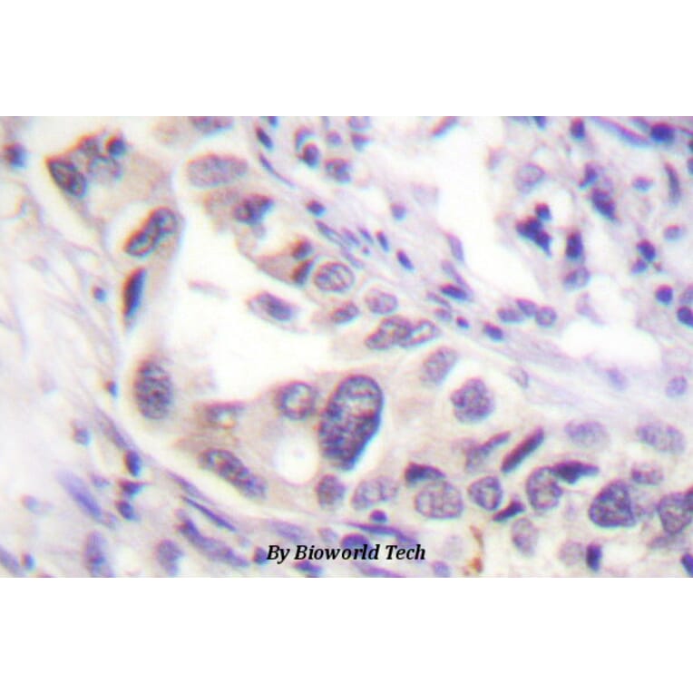 Anti-Smad2 (P459) Antibody from Bioworld Technology (BS1425) - Antibodies.com