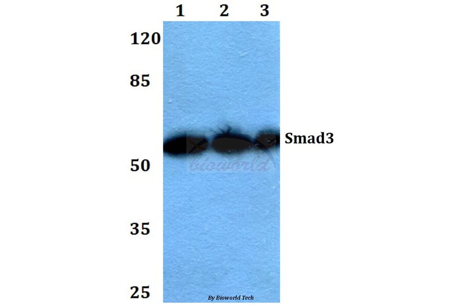 Anti-Smad3 (P417) Antibody from Bioworld Technology (BS1426) - Antibodies.com