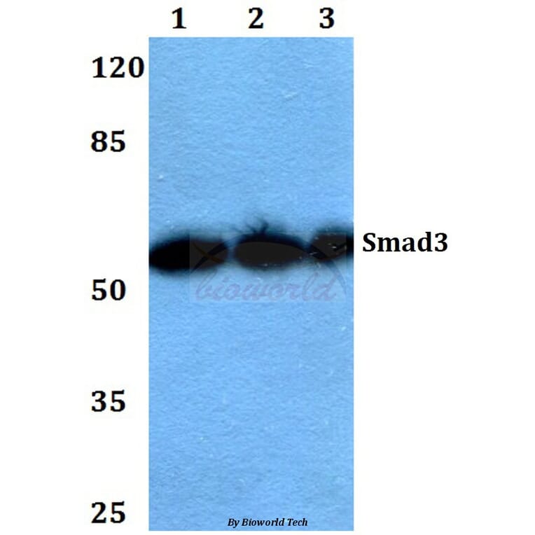 Anti-Smad3 (P417) Antibody from Bioworld Technology (BS1426) - Antibodies.com