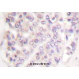 Anti-Smad3 (P417) Antibody from Bioworld Technology (BS1426) - Antibodies.com