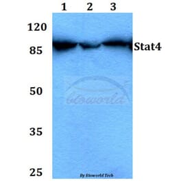 Anti-Stat4 (E687) Antibody from Bioworld Technology (BS1427) - Antibodies.com