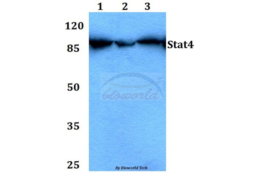 Anti-Stat4 (E687) Antibody from Bioworld Technology (BS1427) - Antibodies.com