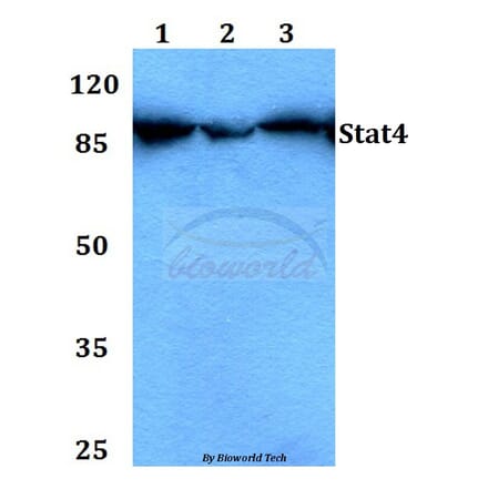 Anti-Stat4 (E687) Antibody from Bioworld Technology (BS1427) - Antibodies.com