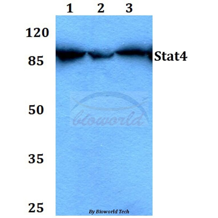 Anti-Stat4 (E687) Antibody from Bioworld Technology (BS1427) - Antibodies.com