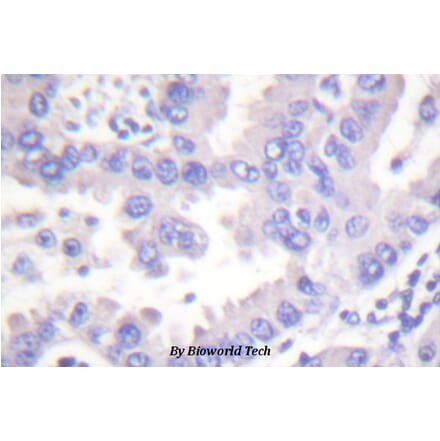 Anti-Syk (P342) Antibody from Bioworld Technology (BS1428) - Antibodies.com