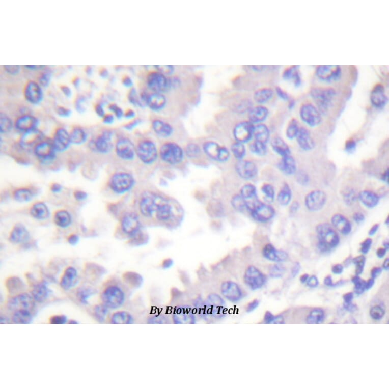 Anti-Syk (P342) Antibody from Bioworld Technology (BS1428) - Antibodies.com
