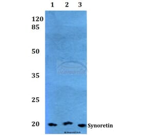 Anti-Synoretin (A111) Antibody from Bioworld Technology (BS1429) - Antibodies.com