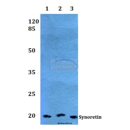 Anti-Synoretin (A111) Antibody from Bioworld Technology (BS1429) - Antibodies.com