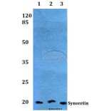 Anti-Synoretin (A111) Antibody from Bioworld Technology (BS1429) - Antibodies.com