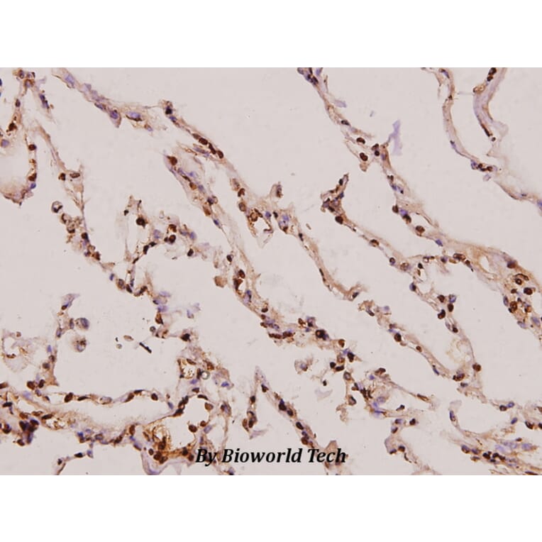 Anti-Synoretin (A111) Antibody from Bioworld Technology (BS1429) - Antibodies.com