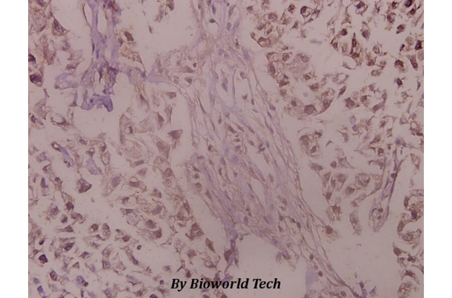 Anti-Trk A (A785) Antibody from Bioworld Technology (BS1430) - Antibodies.com