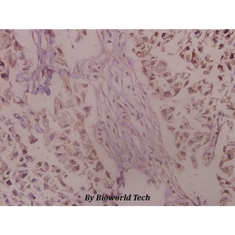 Anti-Trk A (A785) Antibody from Bioworld Technology (BS1430) - Antibodies.com