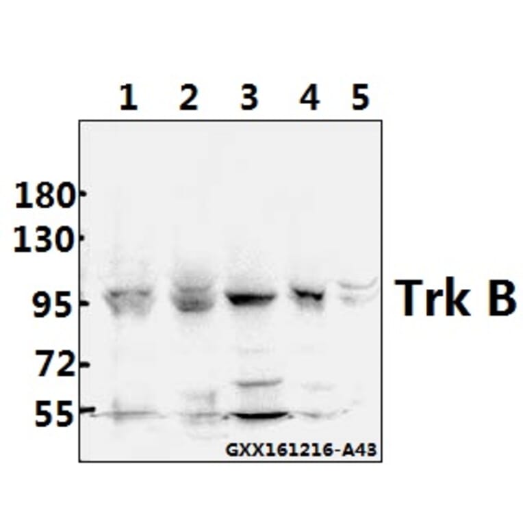 Anti-Trk B (V509) Antibody from Bioworld Technology (BS1431) - Antibodies.com
