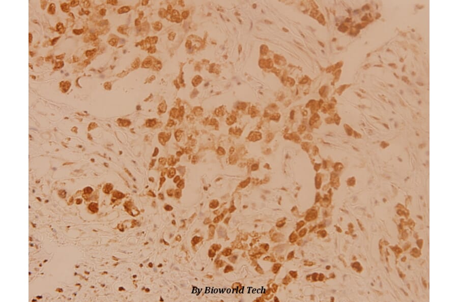 Anti-TH (Q25) Antibody from Bioworld Technology (BS1432) - Antibodies.com