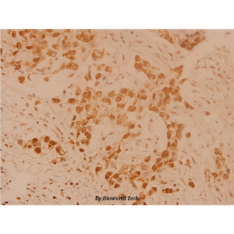 Anti-TH (Q25) Antibody from Bioworld Technology (BS1432) - Antibodies.com